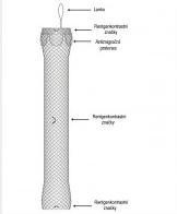stent_196 stent_196